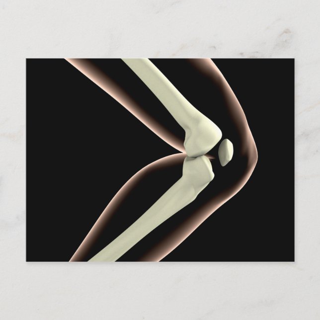 X-Ray-bild av knölar 1 Vykort (Framsida)