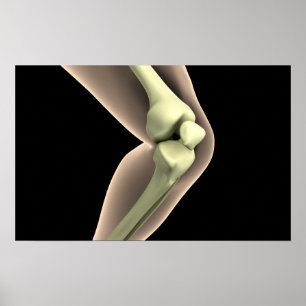 X-Ray-bild av knölar 2 Poster
