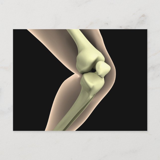 X-Ray-bild av knölar 2 Vykort (Framsida)