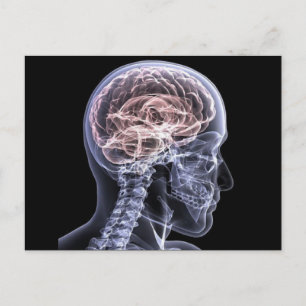 X-Ray Brain Vykort