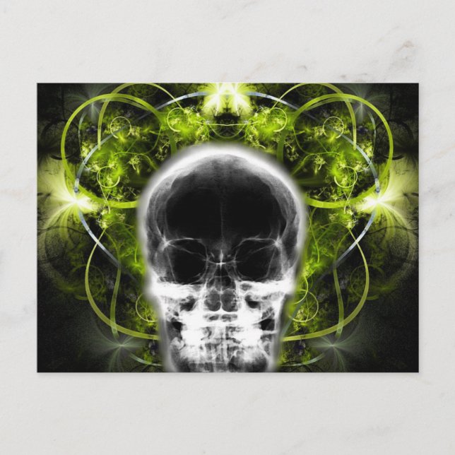 X-Ray Butterfly Fractal Skull - Lime Green Vykort (Framsida)