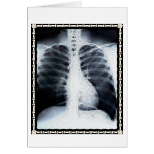 X-Ray Chest Hälsningskort