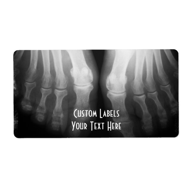 X-Ray Feet Human Skeleton Bones Black & White Fraktsedel (Framsidan)