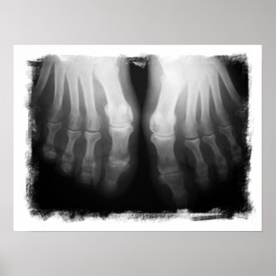 X-Ray Feet Human Skeleton Bones Black & White Poster