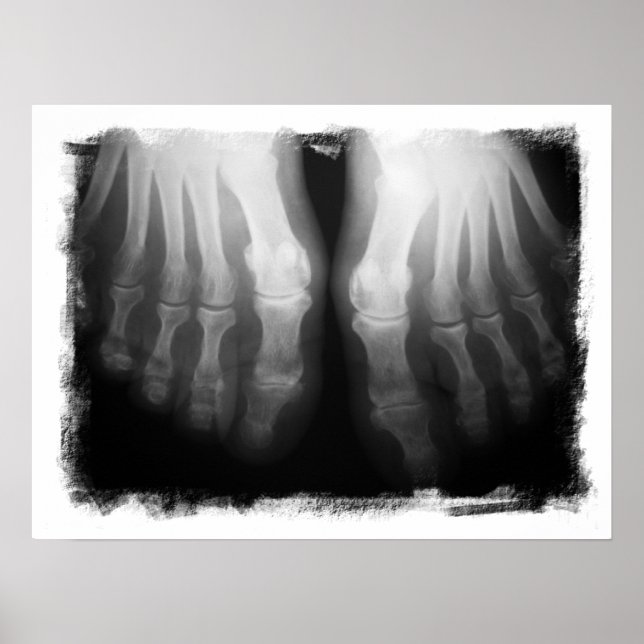 X-Ray Feet Human Skeleton Bones Black & White Poster (Framsidan)