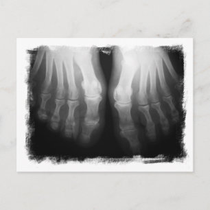 X-Ray Feet Human Skeleton Bones Black & White Vykort
