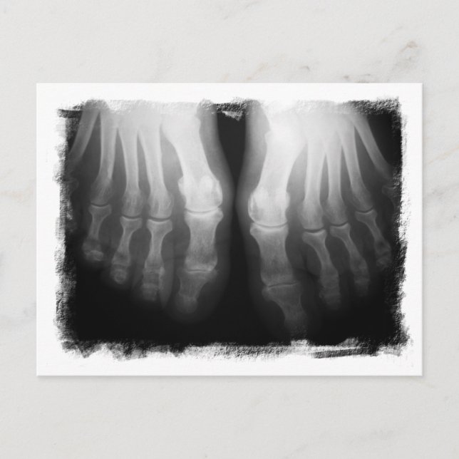 X-Ray Feet Human Skeleton Bones Black & White Vykort (Framsida)