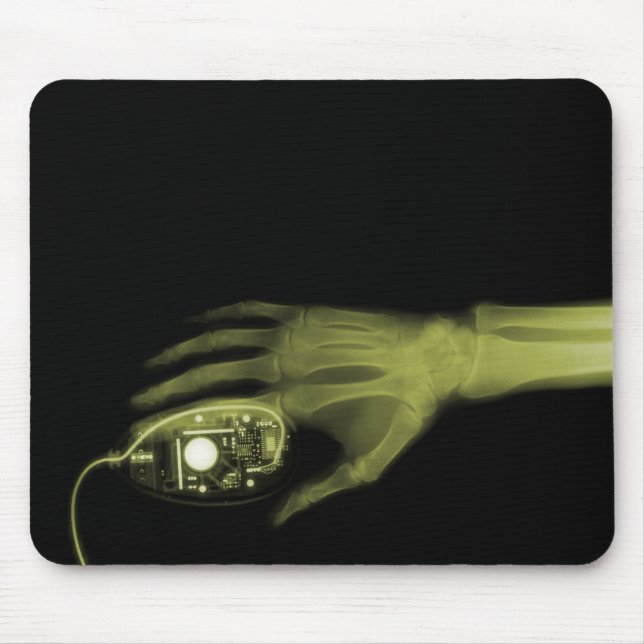 X-Ray Hand & Computer Mouse Musmatta (Framsidan)