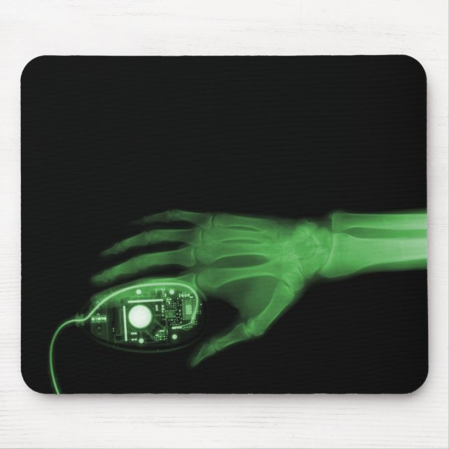 X-Ray Hand & Computer Mouse Musmatta (Framsidan)