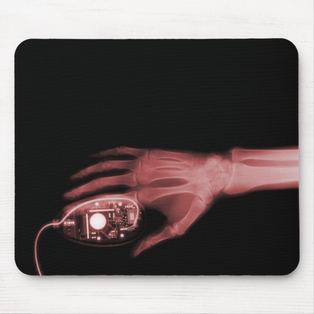 X-Ray Hand & Computer Mouse Musmatta (Framsidan)