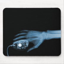 X-Ray Hand & Computer Mouse