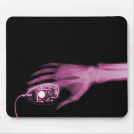 X-Ray Hand & Computer Mouse Musmatta