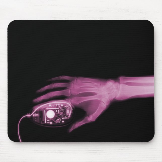 X-Ray Hand & Computer Mouse Musmatta (Framsidan)