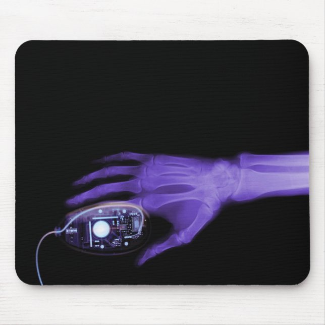X-Ray Hand & Computer Mouse Musmatta (Framsidan)