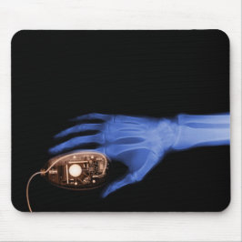 X-Ray Hand & Computer Mouse Musmatta