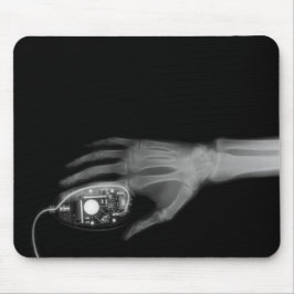 X-Ray Hand & Computer Mouse Musmatta