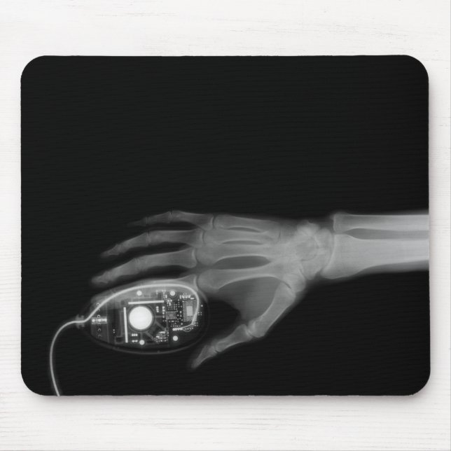 X-Ray Hand & Computer Mouse Musmatta (Framsidan)