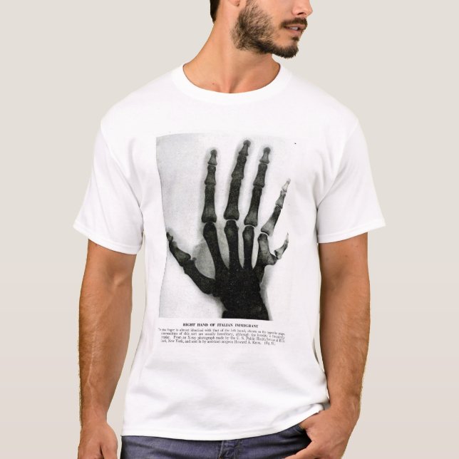 X-Ray Hand med Extra Finger Shirt T-shirt (Framsida)