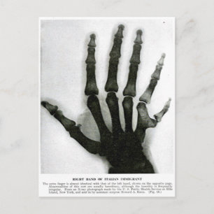 X-Ray Hand med vykort Extra Finger