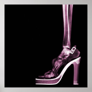 X-RAY HEEL DAM SKELETON FOOT ROSA POSTER