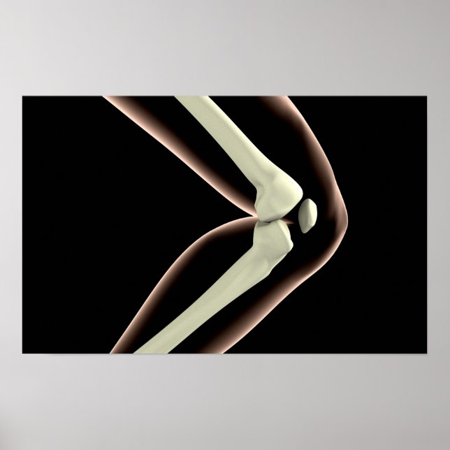 X-Ray Image Of Knee 1 Poster (Framsidan)