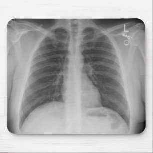 X-Ray Mousepad Musmatta