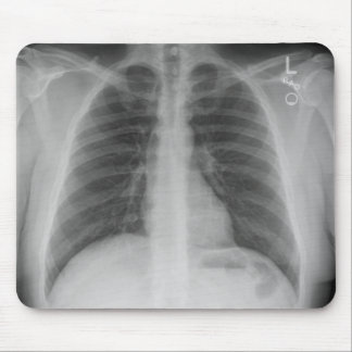 X-Ray Mousepad Musmatta