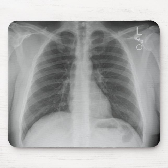 X-Ray Mousepad Musmatta (Framsidan)