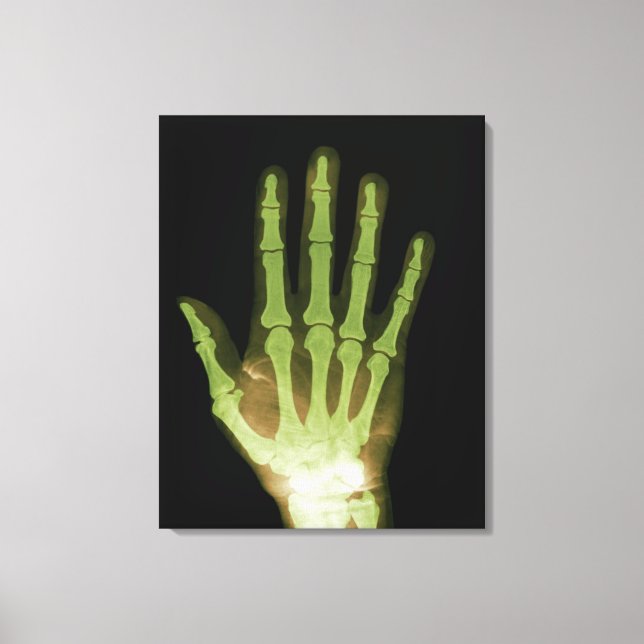 X-ray of Human Hand Canvastryck (Framsida)
