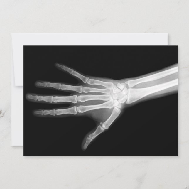 X-Ray Skeleton Arm Black & White Inbjudningar (Framsida)