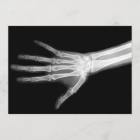 X-Ray Skeleton Arm Black & White