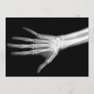 X-Ray Skeleton Arm Black & White Inbjudningar