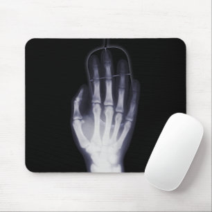 X-Ray Skeleton Hand Xray Musmatta