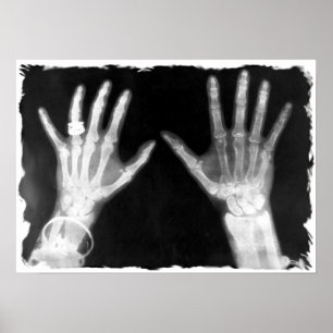 X-Ray Skeleton Händer & Jewelry - B&W Poster