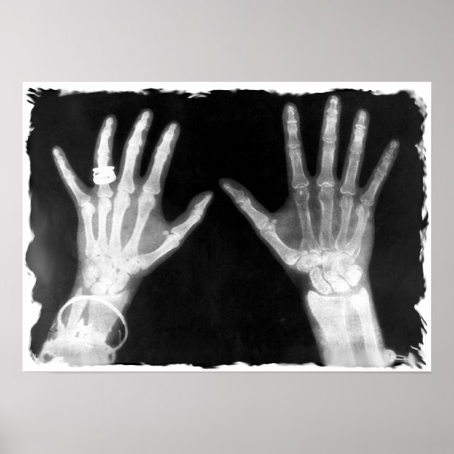 X-Ray Skeleton Händer & Jewelry - B&W Poster (Framsidan)