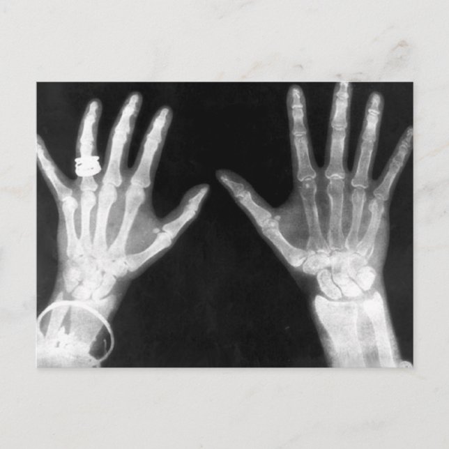 X-Ray Skeleton Händer & Jewelry - B&W Vykort (Framsida)