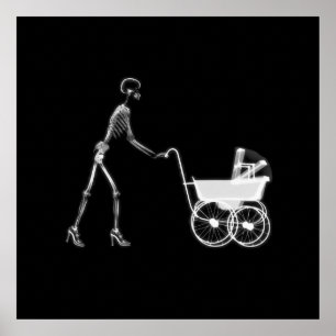 X-Ray Skeleton Mamma & Baby - Original B&W Poster