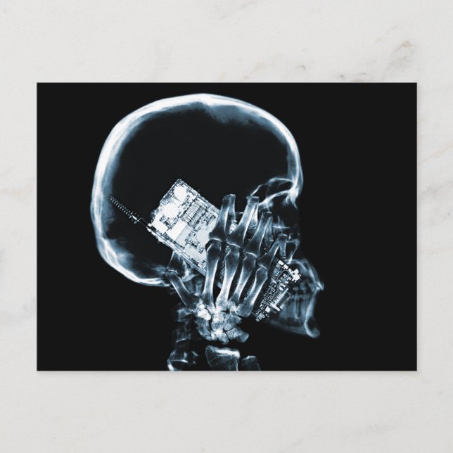 X-RAY SKELETON PÅ MOBIL - BLUE VYKORT (Framsida)