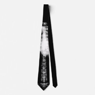 X-Ray Skeleton Ribs & Spine Slips