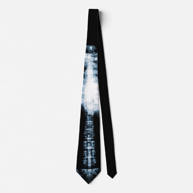 X-Ray Skeleton Ribs & Spine Slips (Framsida)