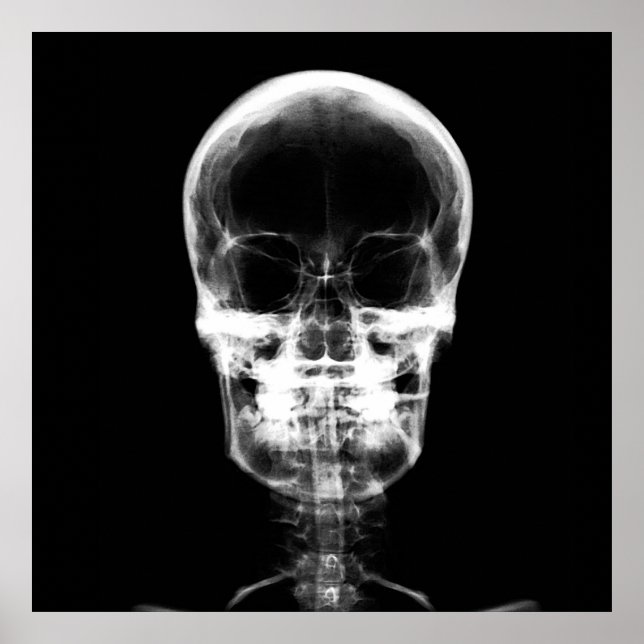 X-Ray Skeleton Skull - B&W Poster (Framsidan)