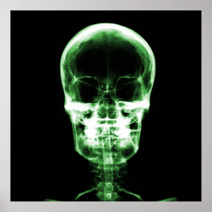 X-Ray Skeleton Skull - Grönt Poster