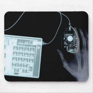 X-Ray Skeleton Tangentbord & Mouse Mouse Pad Musmatta