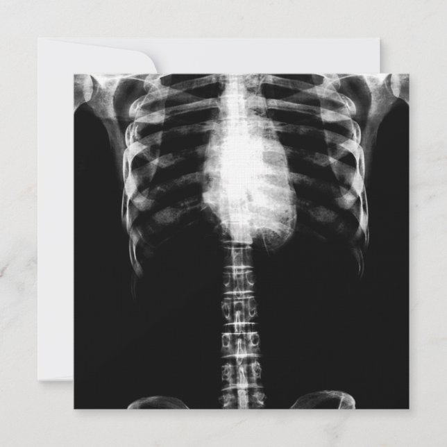X-RAY SKELETON TORSO RIBS - B&W INBJUDNINGAR (Framsida)