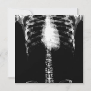 X-RAY SKELETON TORSO RIBS - B&W INBJUDNINGAR