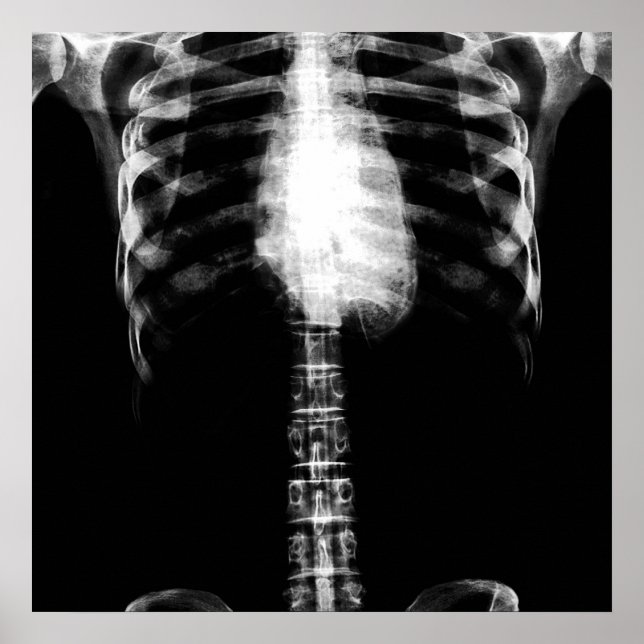 X-RAY SKELETON TORSO RIBS - B&W POSTER (Framsidan)