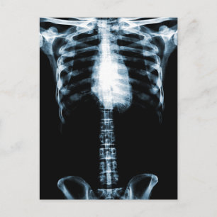X-RAY SKELETON TORSO RIBS BLUE VYKORT