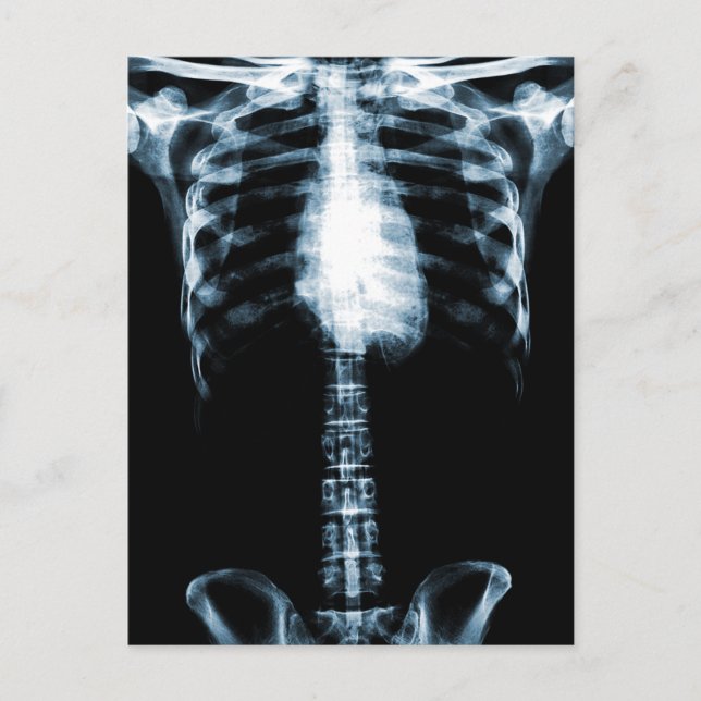 X-RAY SKELETON TORSO RIBS BLUE VYKORT (Framsida)