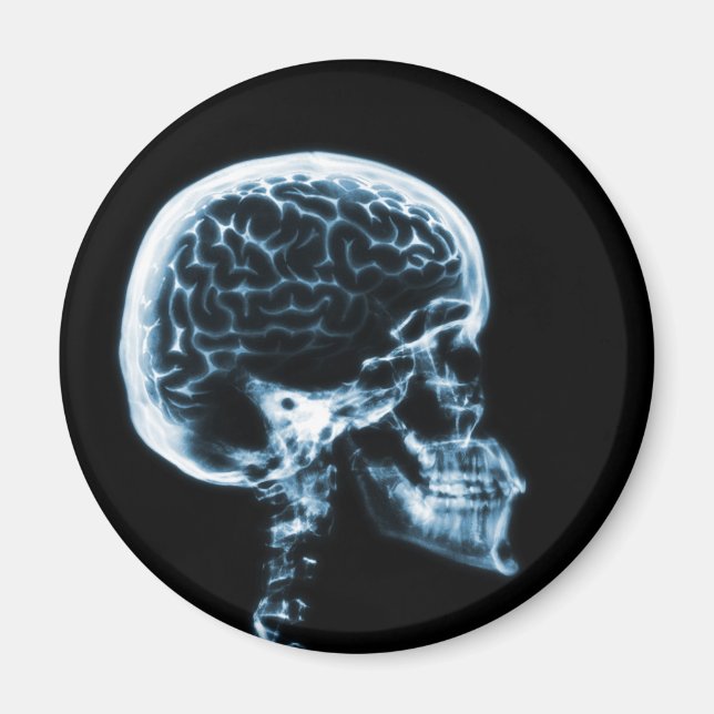 X-RAY SKULL BRAIN - BLUE MAGNET (Framsidan)