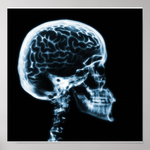 X-RAY SKULL BRAIN - BLUE POSTER